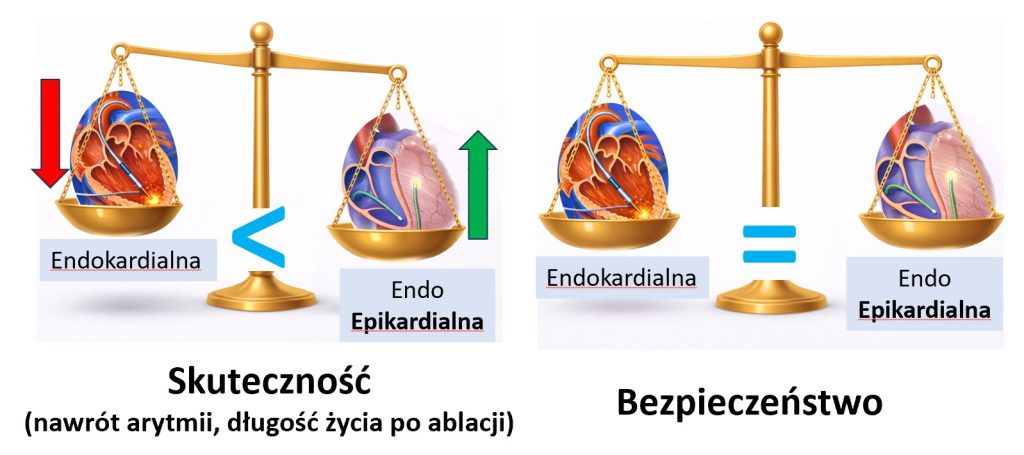 Porównanie ablacji endokardialnej i epikardialnej – skuteczność oraz bezpieczeństwo zabiegu